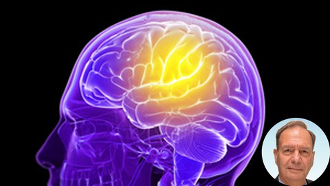 AI -Artificial Intelligence intro in Healthcare,Plain & Simple